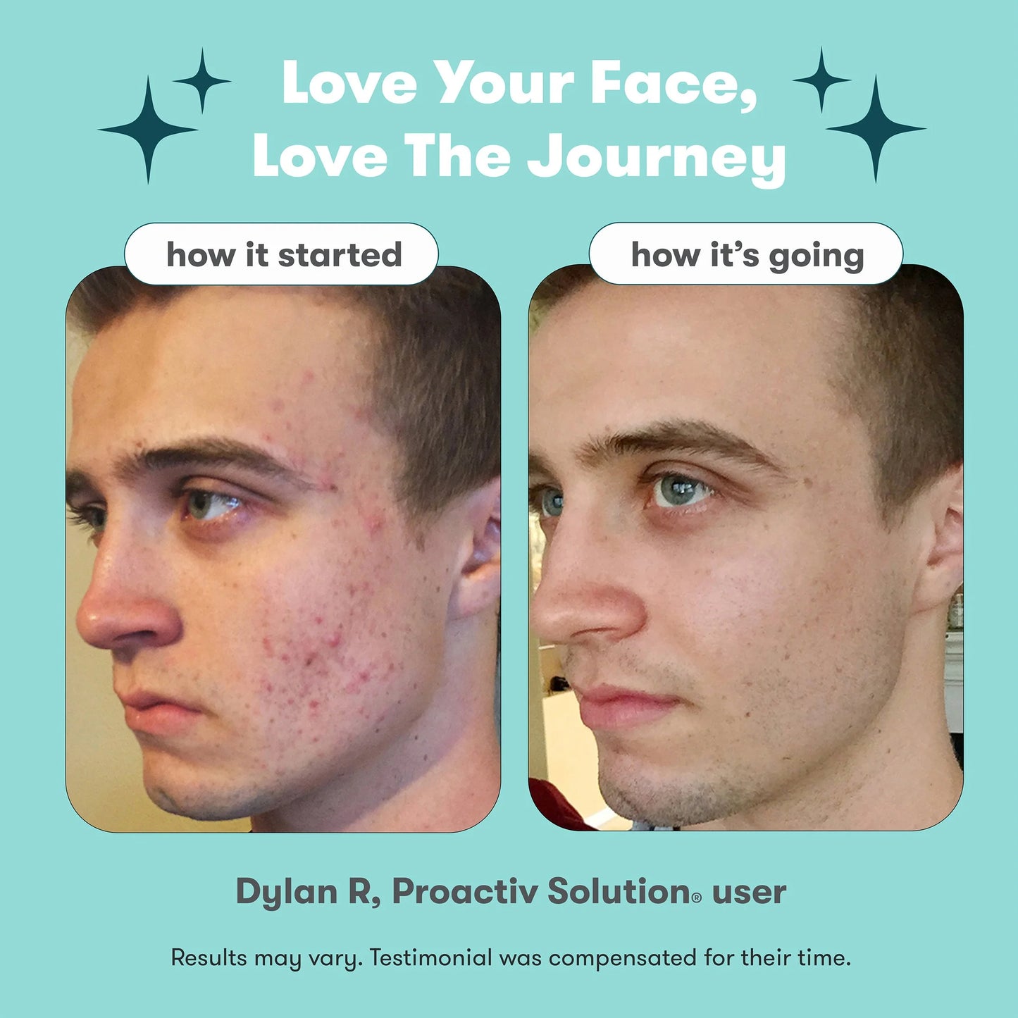 Solution Mini 3-Step Acne Treatment System